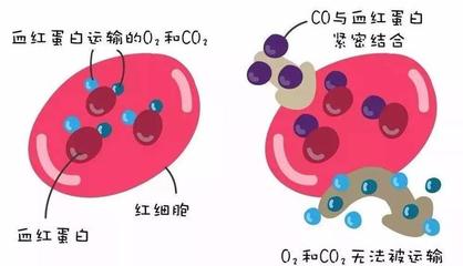警惕洗澡季隱形殺手 一氧化碳中毒康復(fù)后，當(dāng)心遲發(fā)性腦病